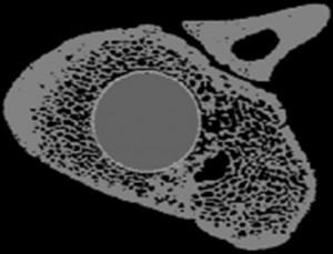 CT-Bild nach automatischer Auswertung (segmentiert): Bild ist aufgeteilt in Knochen, Beschichtung und Implantatvolumen (Institut für Biomechanik, ETH Zürich, Zürich)